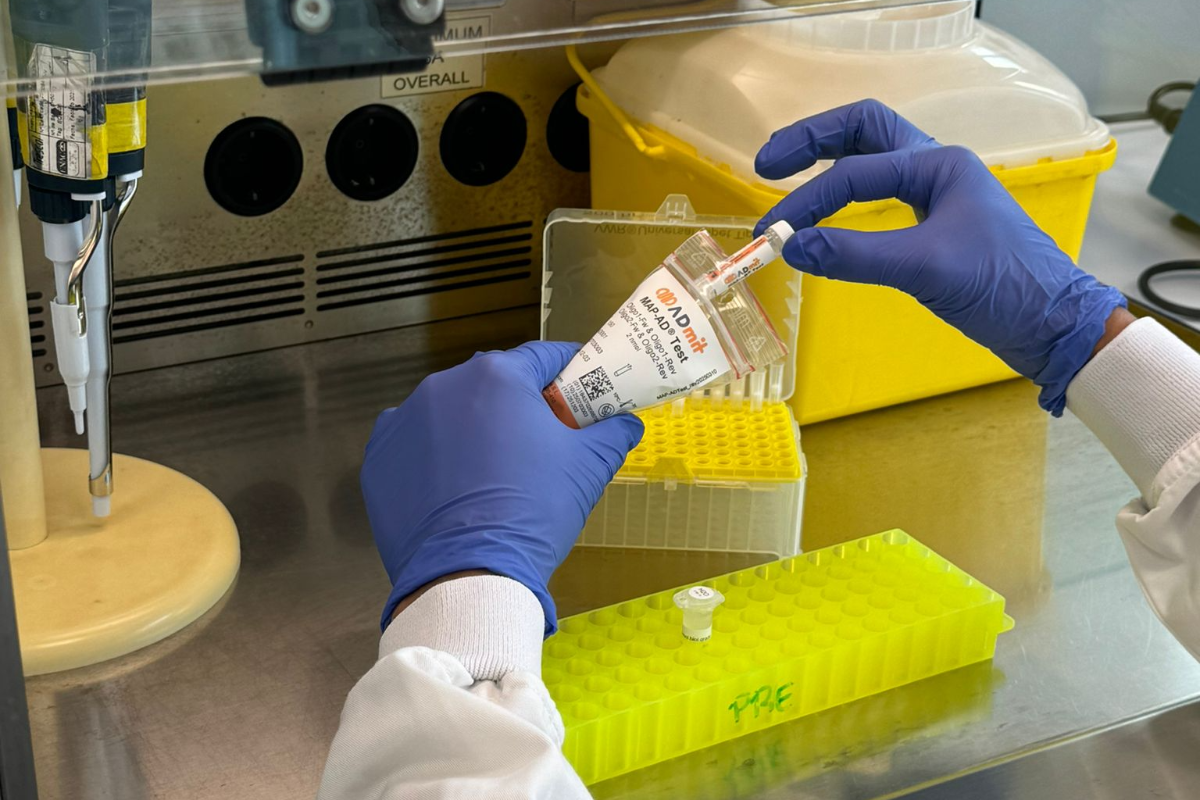Bellvitge valida un biomarcador en sangre capaz de anticipar la progresión del alzhéimer