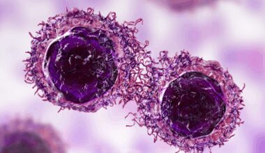 Pirotinib y oxaliplatino reducen la carga tumoral en un modelo de cáncer gástrico