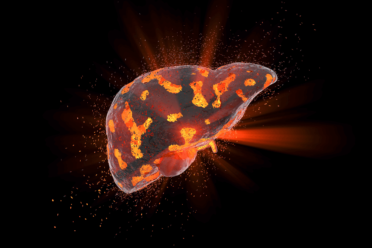 Setanaxib muestra actividad en modelos preclínicos de colangiocarcinoma intrahepático