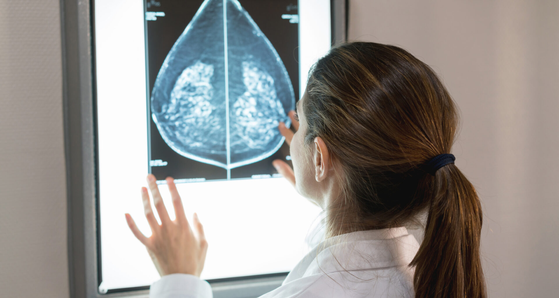 España lidera el cribado de cáncer de mama en Europa
