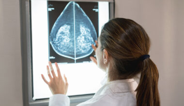 España lidera el cribado de cáncer de mama en Europa