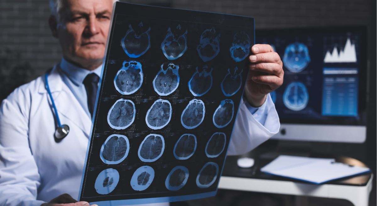 Soy neurólogo y esto es lo que hago todos los días para cuidar el cerebro a largo plazo y no perder la memoria