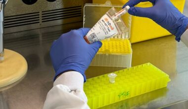 Creado un test sanguíneo capaz de anticipar la progresión a demencia del Alzheimer leve
