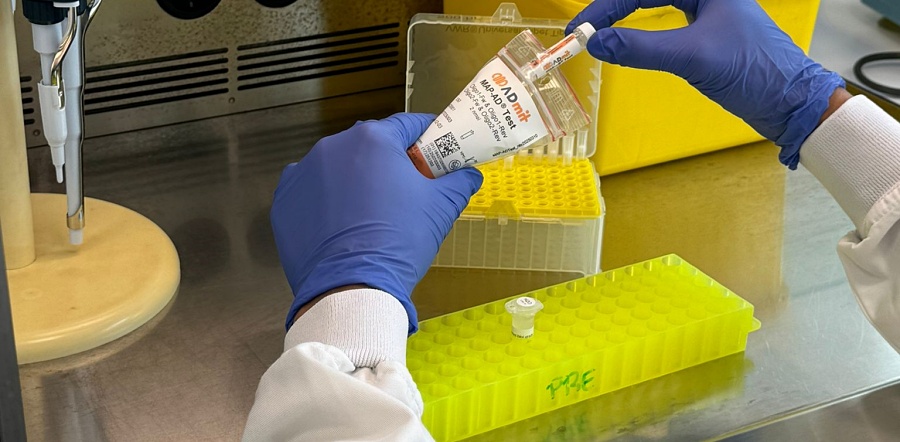 Creado un test sanguíneo capaz de anticipar la progresión a demencia del Alzheimer leve