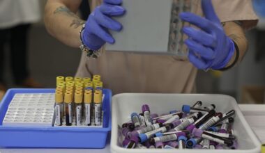 el cáncer que se manifiesta con dolor de huesos y anemia