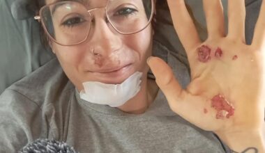 Sheyla Gutiérrez sufre un accidente entrenando por causa de una ardilla albina