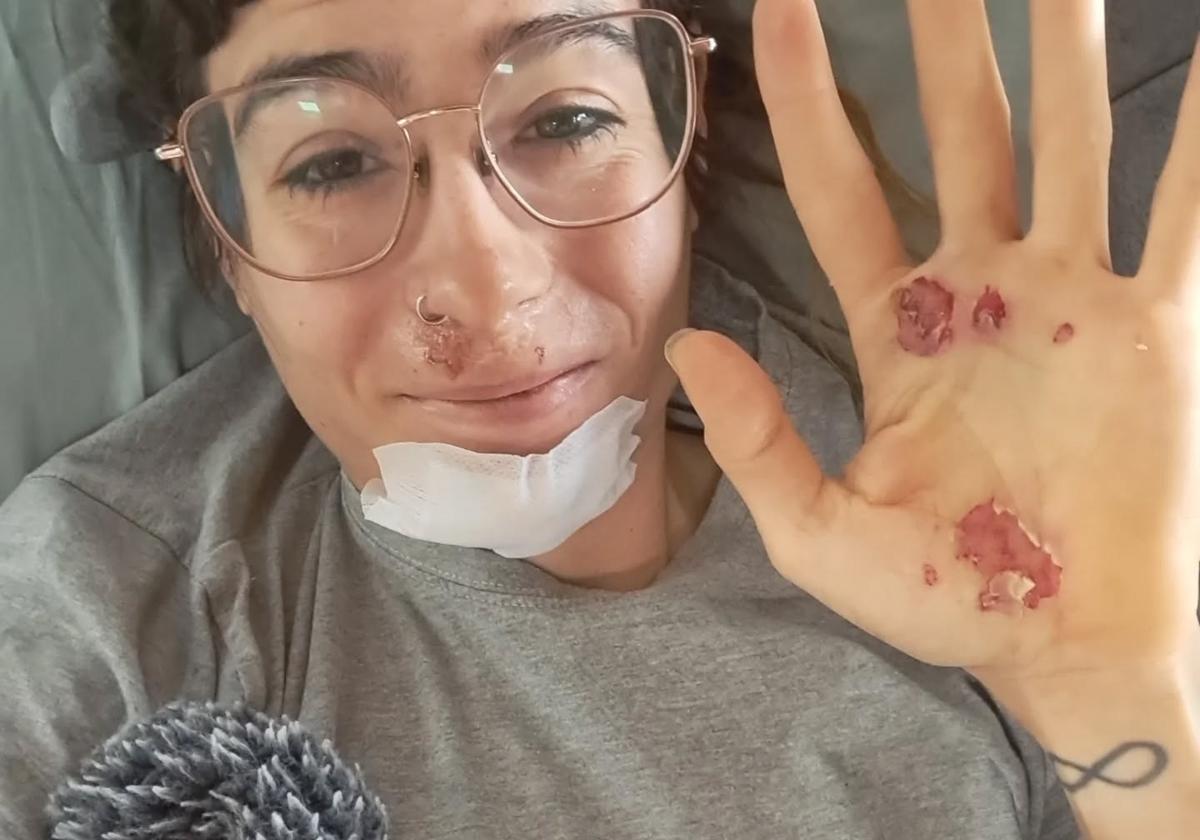 Sheyla Gutiérrez sufre un accidente entrenando por causa de una ardilla albina