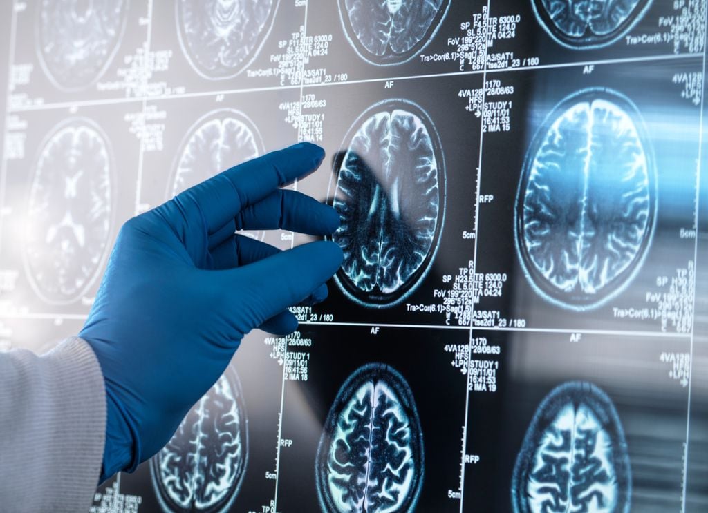 Cerebro