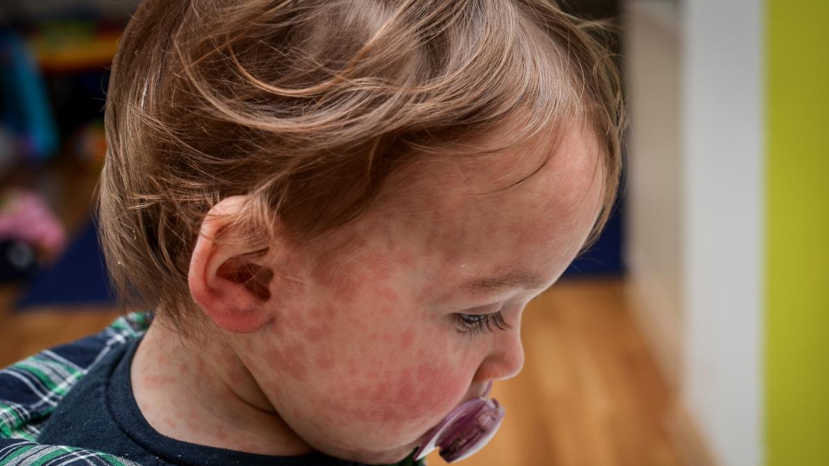 Un pasajero de un importante aeropuerto crea alarma al tener 'una enfermedad de las más infecciosas'