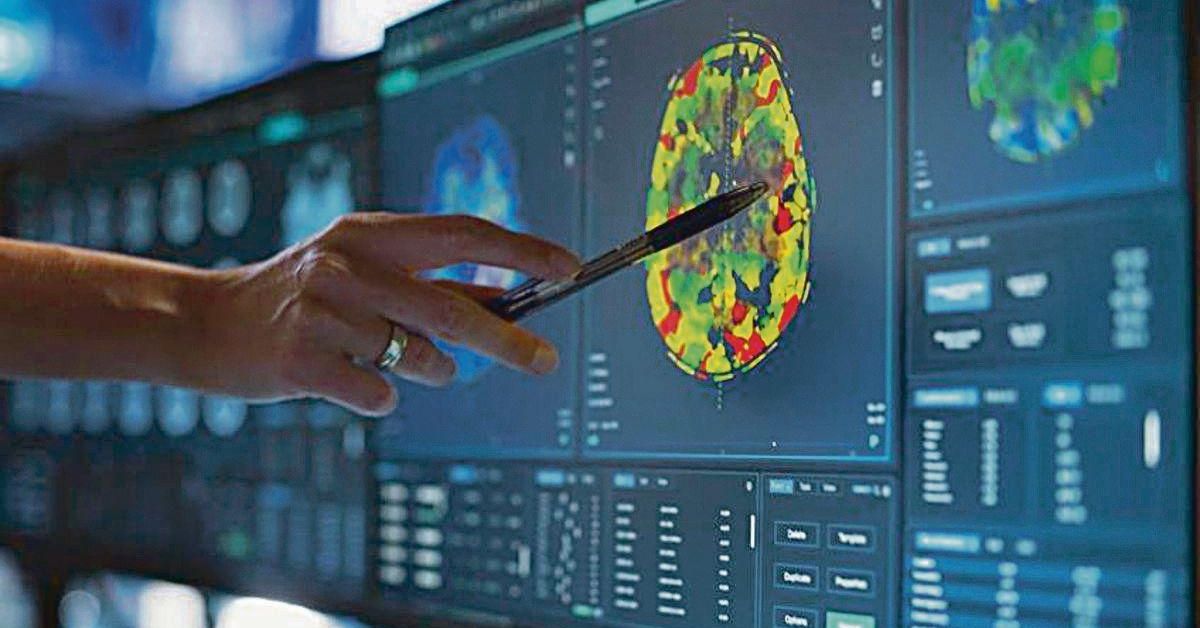 La microbiota puede influir en la salud cognitiva sénior