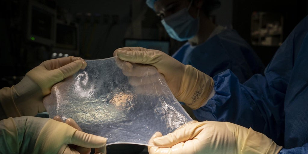 El primer trasplante de un hígado de cerdo a un paciente vivo permite que sobreviva más de medio año