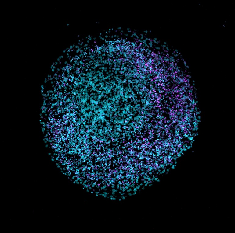 Minicerebros de laboratorio, biotecnología en las fronteras de la neurociencia y la ética