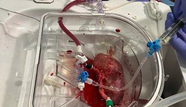 Primer trasplante de riñones modificados con organoides renales humanos en cerdos - El Mundo