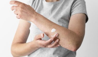 Dermatitis atópica: ¿se puede frenar el curso de la enfermedad?