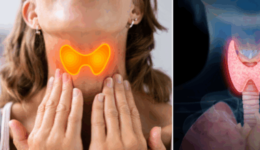 cómo el hipotiroidismo puede causar depresión y ansiedad