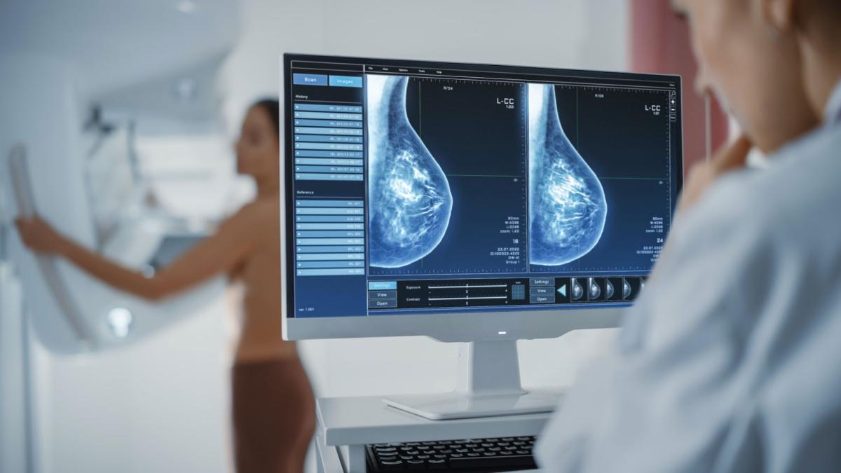 Un estudio halla una terapia con "mayor eficacia" que la estándar en cáncer de mama metastásico