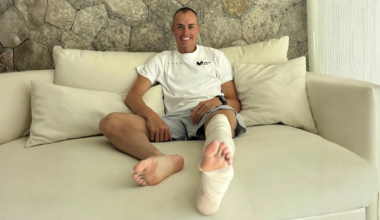 El ciclista Enric Mas pasa por quirófano por unas "formaciones varicosas" en su pierna izquierda