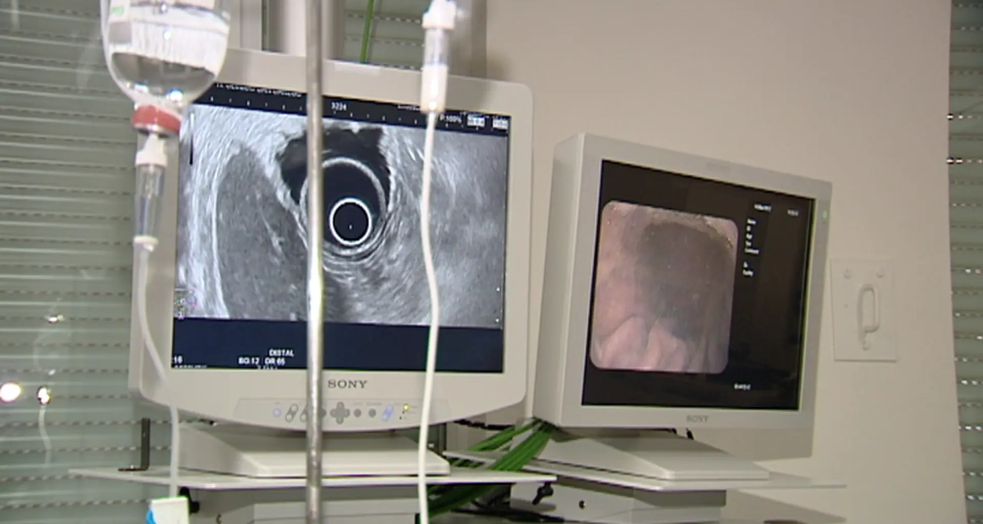 Un estudio halla una terapia con "mayor eficacia" que la estándar en cáncer de mama metastásico