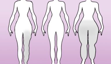 Lipedema y linfedema, dos enfermedades con síntomas parecidos, pero tratamientos distintos | Líder en Información Social