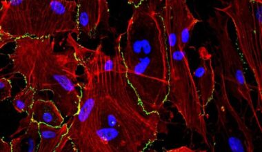 Un hidrogel en spray muestra resultados prometedores para prevenir complicaciones tras una cirugía abdominal