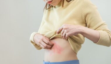 Estudio sugiere que vacuna contra la culebrilla previene el riesgo de demencia y enfermedades cardíacas