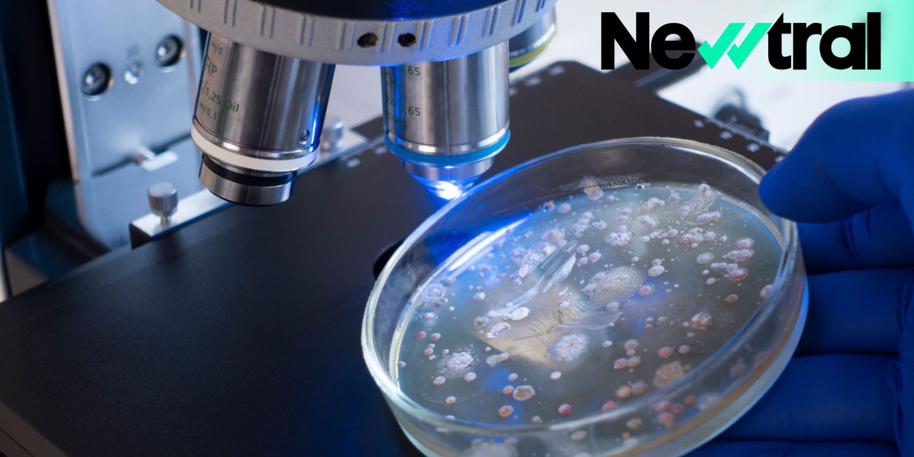 Estas son las cuatro bacterias que más preocupan por su resistencia