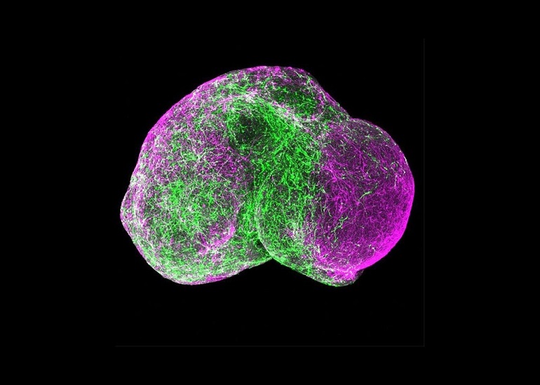 Minicerebros de laboratorio, biotecnología en las fronteras de la neurociencia y la ética
