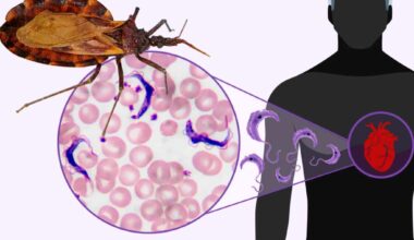Identifican tres biomarcadores que podrían predecir el daño cardíaco en la enfermedad de Chagas