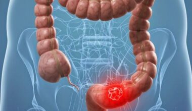 El sangrado rectal en menores de 50 Años dispara 8,5 veces el riesgo de cáncer colorrectal, según un estudio