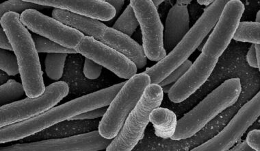 Escherichia coli , una de las muchas especies de bacterias presentes en el intestino humano.