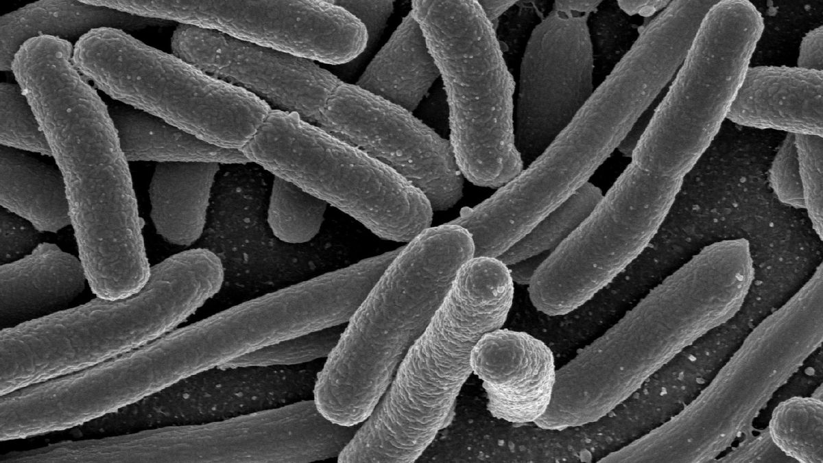 Escherichia coli , una de las muchas especies de bacterias presentes en el intestino humano.