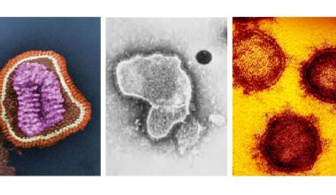Castilla-La Mancha refuerza la red de médicos centinela