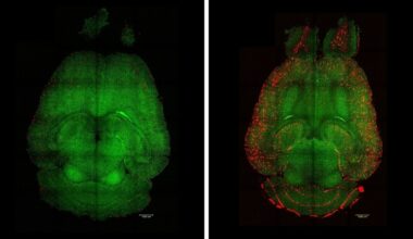 Consiguen revertir el alzhéimer en ratones con el uso de nanopartículas