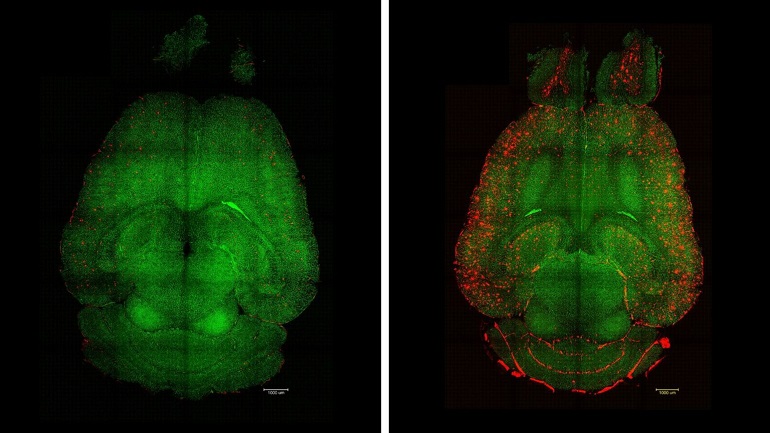 Consiguen revertir el alzhéimer en ratones con el uso de nanopartículas