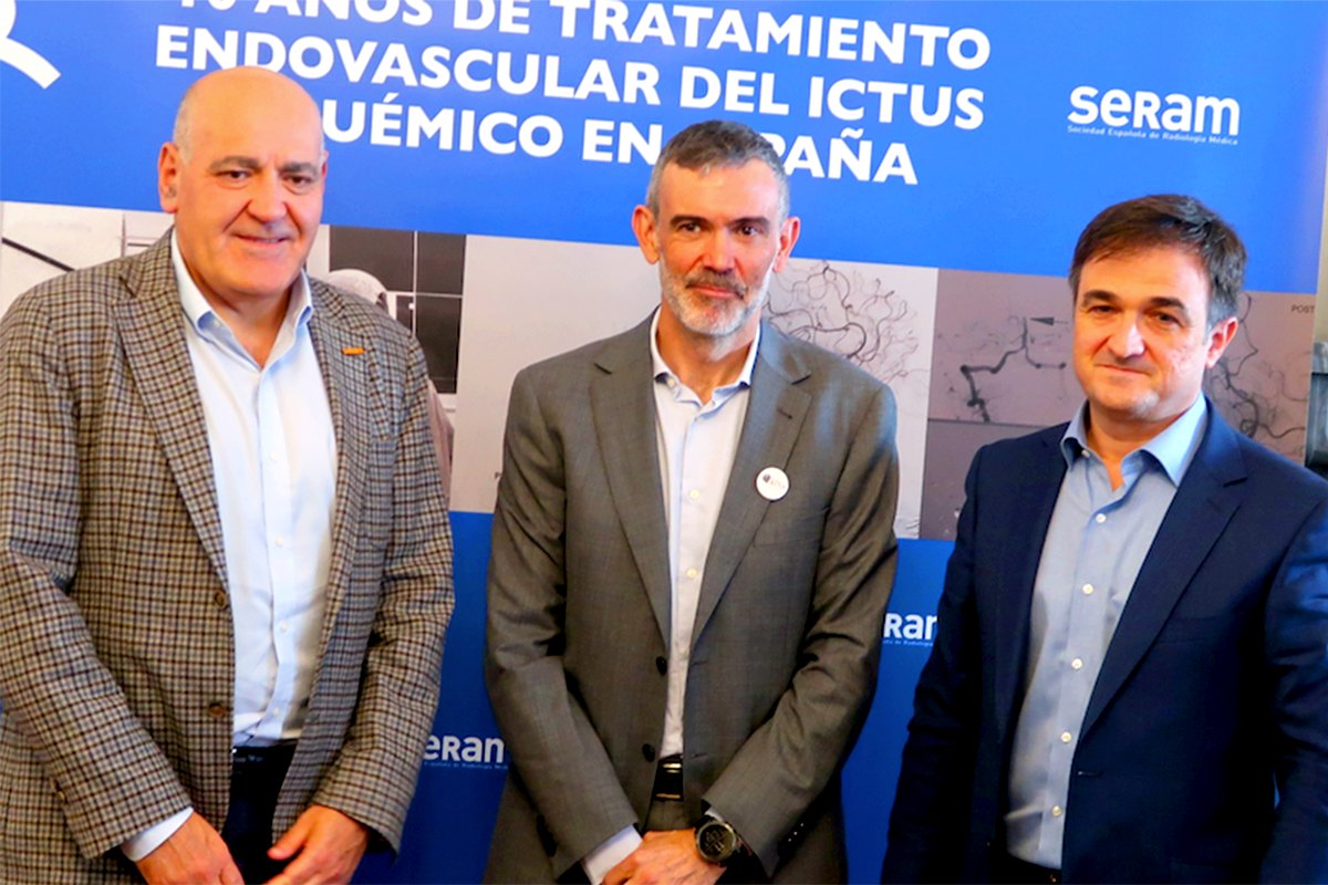 España puntúa muy alto en intervencionismo por ictus pero suspende clamorosamente en rehabilitación