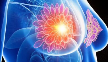 Así beneficia la secuenciar el genoma completo a las mujeres con cáncer de mama