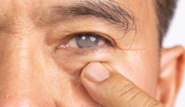 "El ojo seco es un síntoma extendido entre la población, afectando al 27% de los españoles"