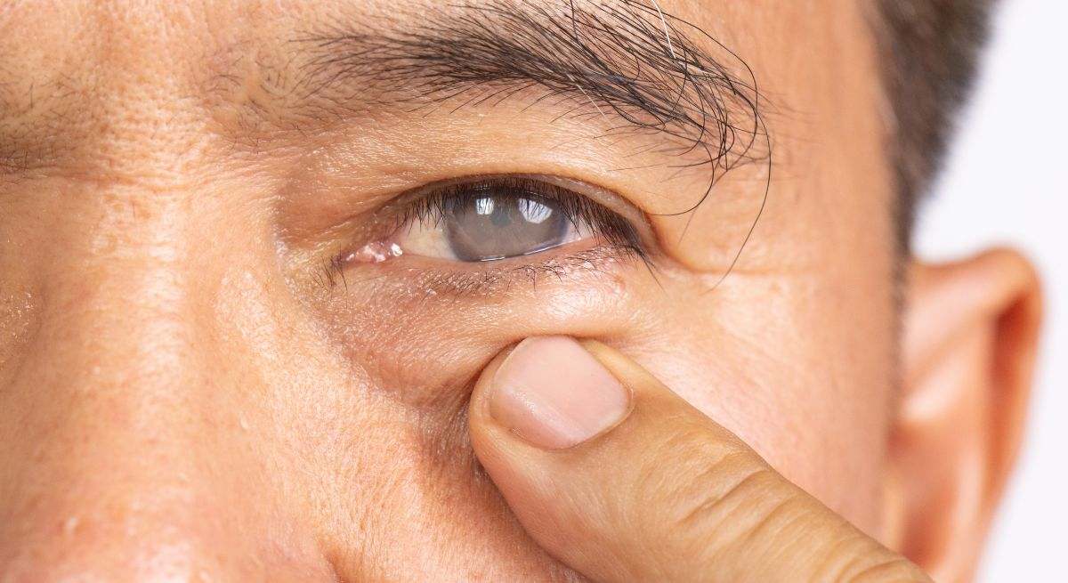 "El ojo seco es un síntoma extendido entre la población, afectando al 27% de los españoles"