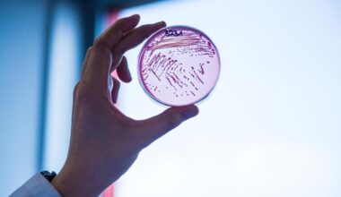 Archivo - Imagen de archivo de bacterias resistente a múltiples fármacos.