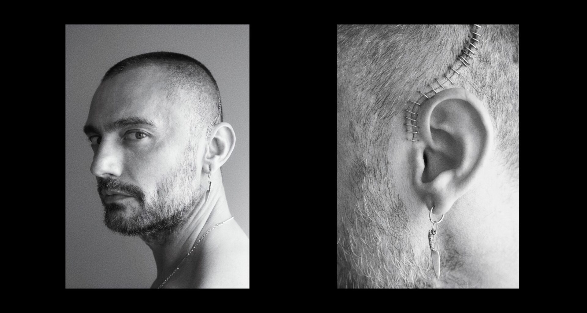 El significado de 'Muestra tu herida', el documental de David Delfín