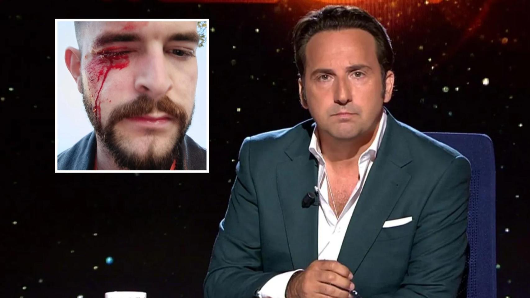 "La caza al periodista no es espontánea"