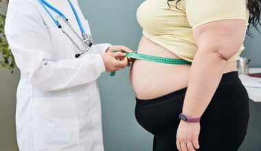 Una persona con obesidad gasta en sanidad casi cuatro veces más que la media de una familia entera española