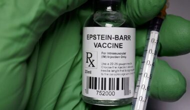 El virus común que causa la mononucleosis, identificado como posible detonante del lupus