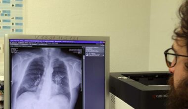 España es el país europeo en el que más crece el cáncer de pulmón femenino