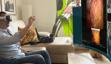 "Estaba en mi salón, pero tenía la sensación de estar dentro del quirófano"