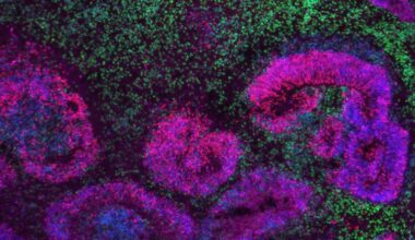 El mayor mapa del cerebro en desarrollo revela las fases en las que se originan los trastornos neurológicos
