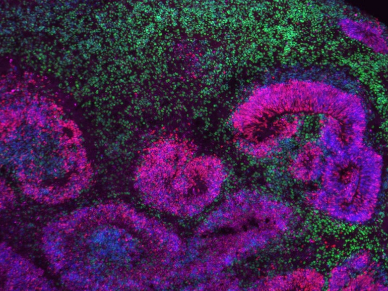 El mayor mapa del cerebro en desarrollo revela las fases en las que se originan los trastornos neurológicos