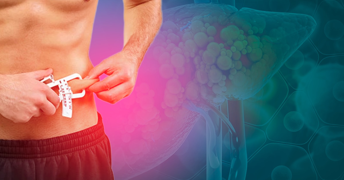 Cuál es el porcentaje de peso corporal que debes bajar para evitar desarrollar hígado graso o revertirlo