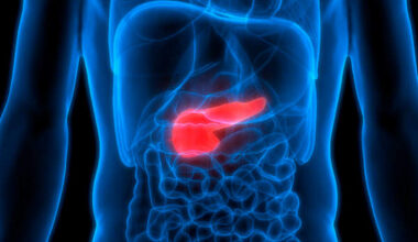 supervivencia baja y aumento de casos en jóvenes