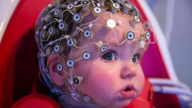 Un bebé lleva un casco con sensores en su cabeza. Tiene ojos azules y va vestido de rojo.